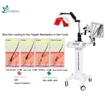 Профессиональный диодный лазерный аппарат для восстановления волос для лечения выпадения волос